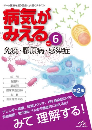 病気がみえる vol.6 免疫・膠原病・感染症